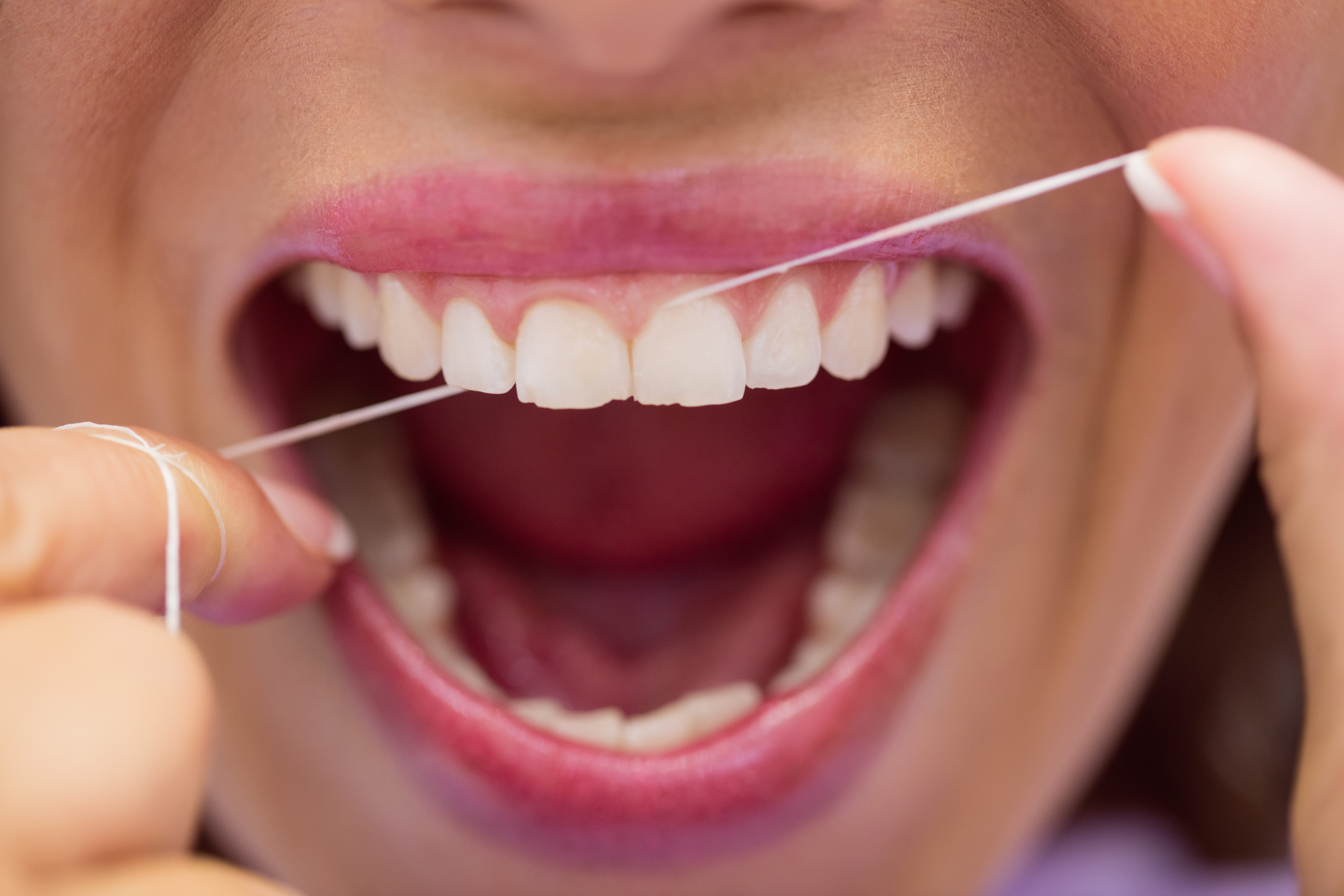 Nitkowanie zębów nicią dentystyczną