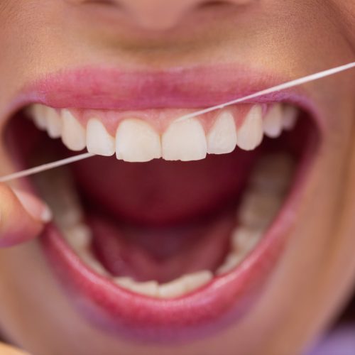 Nitkowanie zębów nicią dentystyczną